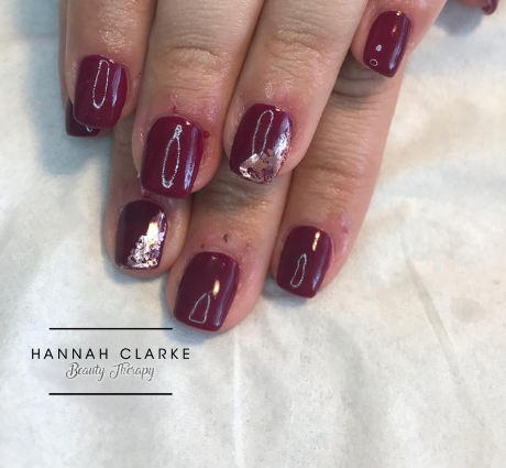 After Nail Treatment in St Helens 2