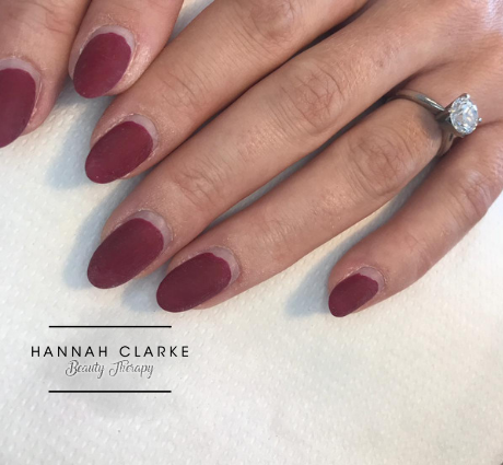 Before Nail Treatment in St Helens